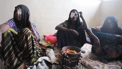Eyes for Africa patients in Ethiopia